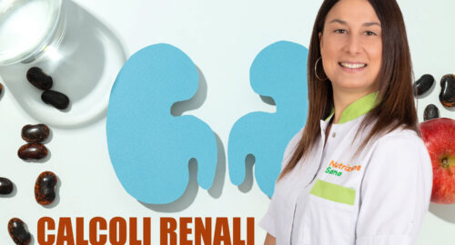 Calcoli Renali su Nutriziona Sana