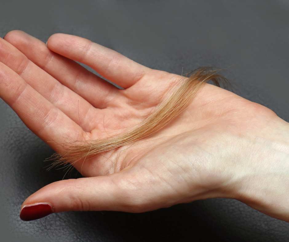 Perdita dei capelli diversi tipi di caduta